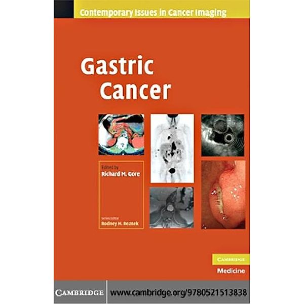 Gastric Cancer