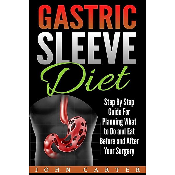 Gastric Sleeve Diet: Step By Step Guide For Planning What to Do and Eat Before and After Your Surgery, John Carter