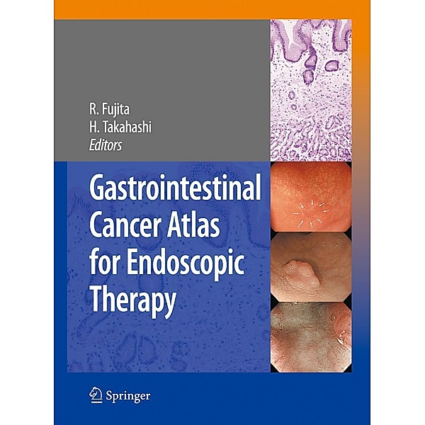 Gastrointestinal Cancer Atlas for Endoscopic Therapy, Rikiya Fujita, Hiroshi Takahashi