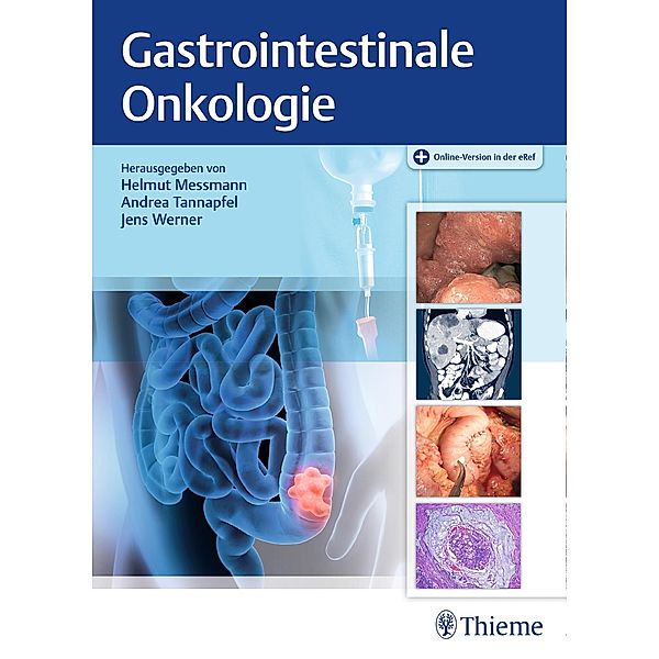 Gastrointestinale Onkologie