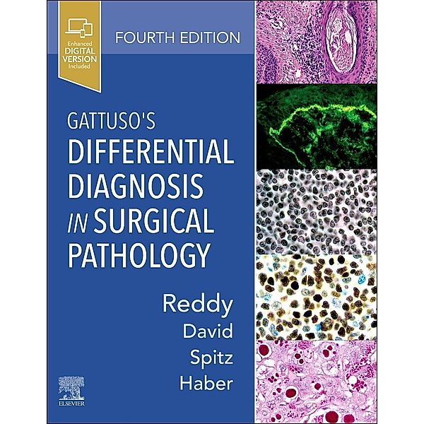 Gattuso's Differential Diagnosis in Surgical Pathology, Vijaya B. Reddy, Odile David, Daniel J. Spitz, Meryl H. Haber