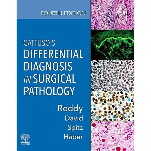Gattuso's Differential Diagnosis in Surgical Pathology, Vijaya B. Reddy, Odile David, Daniel J. Spitz, Meryl H. Haber