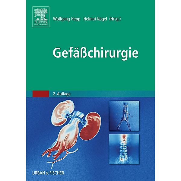 Gefäßchirurgie