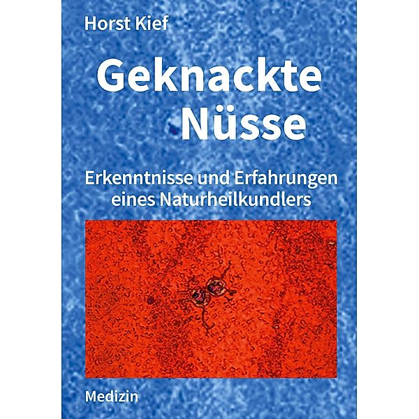Geknackte Nüsse, Horst Kief