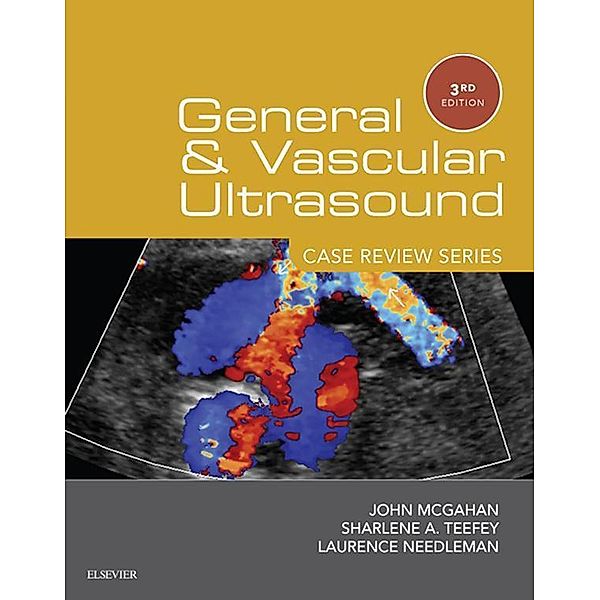 General and Vascular Ultrasound: Case Review Series E-Book / Case Review, John P. McGahan, Sharlene A Teefey, Laurence Needleman