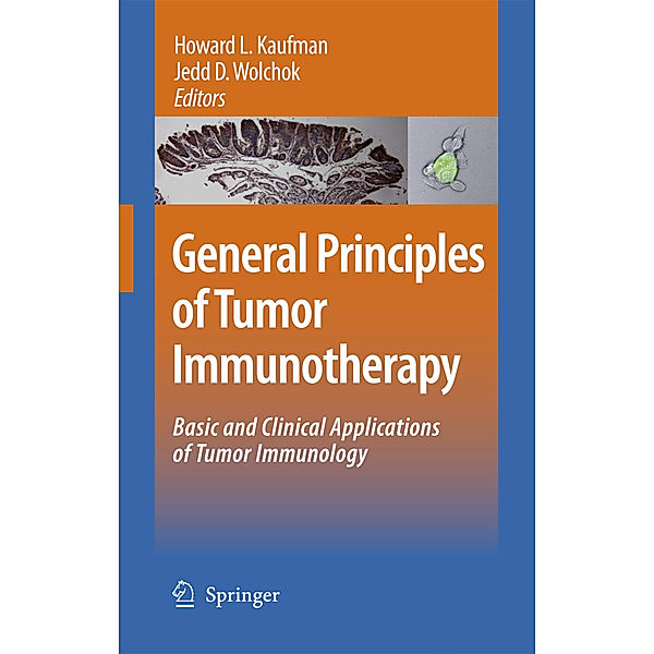 General Principles of Tumor Immunotherapy