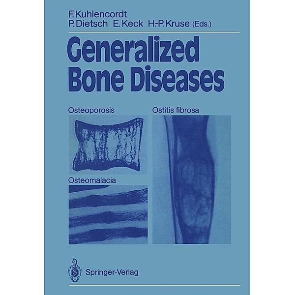 Generalized Bone Diseases