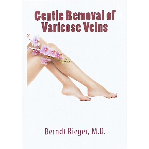 Gentle Removal of Varicose Veins, Berndt Rieger