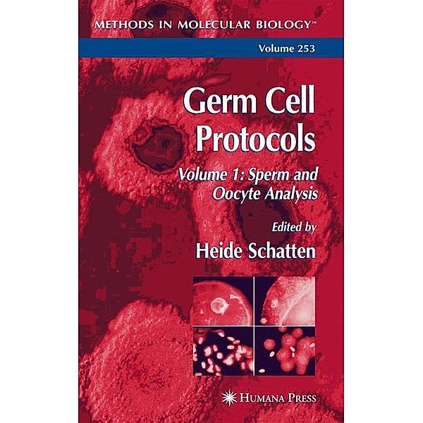 Germ Cell Protocols