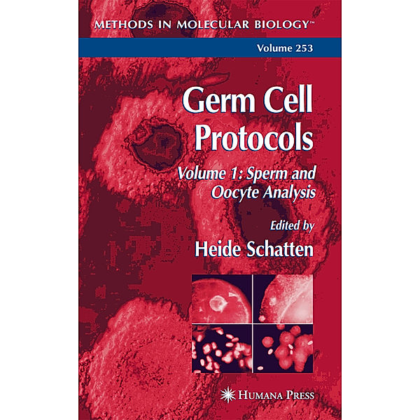 Germ Cell Protocols