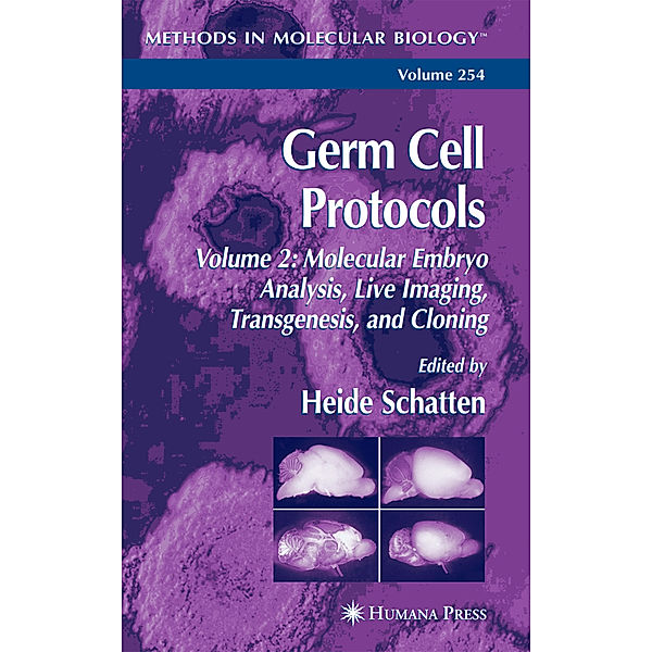 Germ Cell Protocols