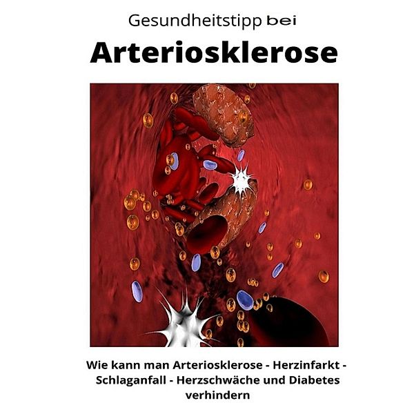 Gesundheitstipp bei Arteriosklerose, Maximilian Loidl