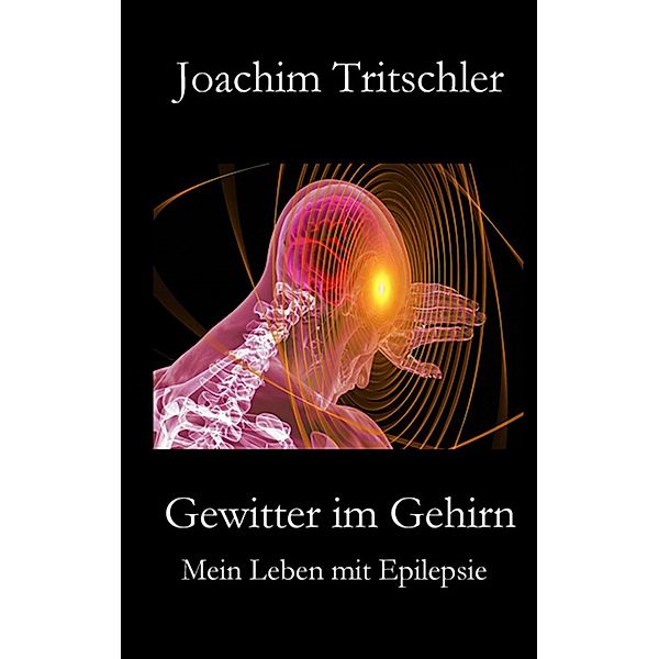 Gewitter im Gehirn, Joachim Tritschler
