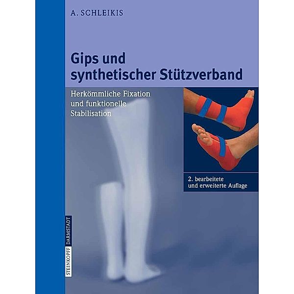 Gips und synthetischer Stützverband, A. Schleikis