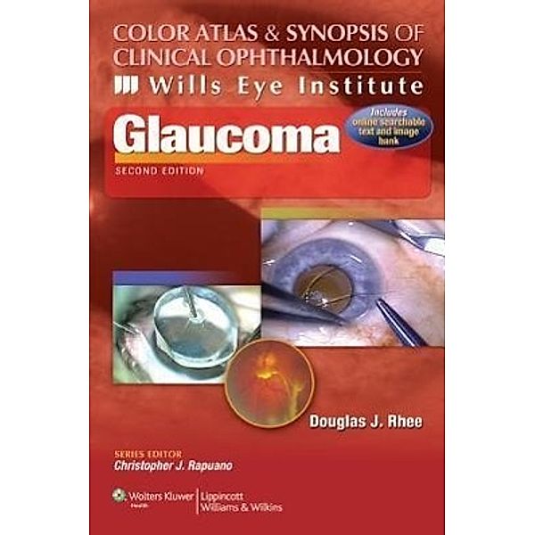 Glaucoma, Douglas J. Rhee