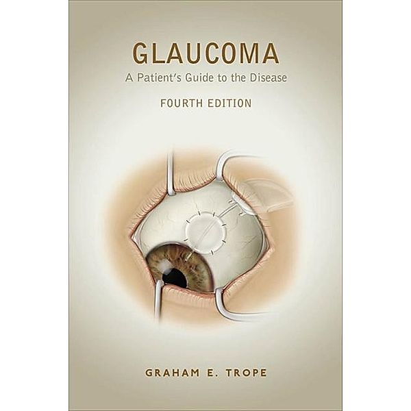 Glaucoma, Graham E. Trope
