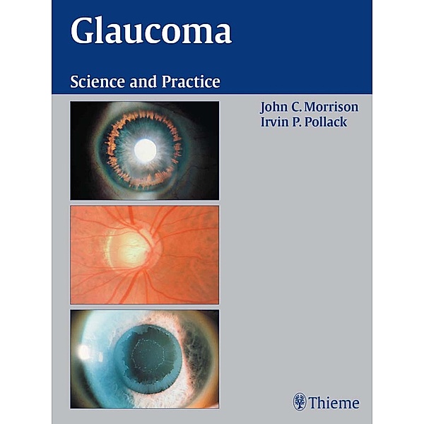 Glaucoma, John C. Morrison, Irvin P. Pollack