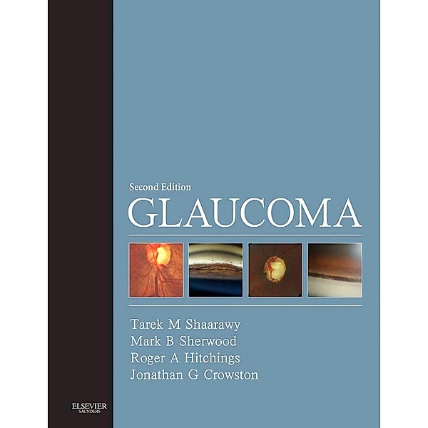 Glaucoma E-Book, Tarek M. Shaarawy, Mark B. Sherwood, Roger A. Hitchings, Jonathan G. Crowston
