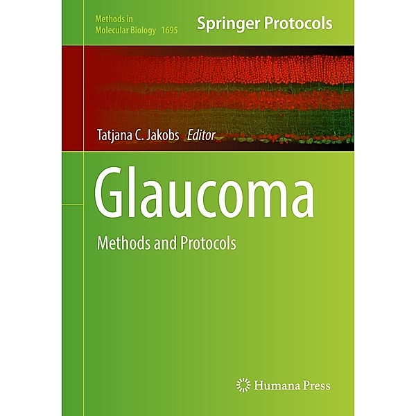 Glaucoma / Methods in Molecular Biology Bd.1695