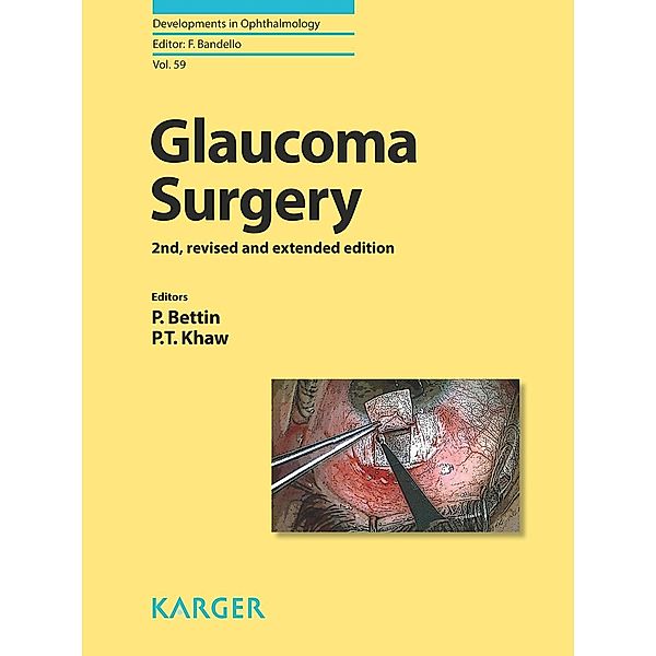 Glaucoma Surgery