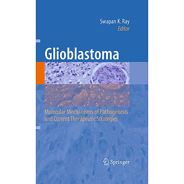 Glioblastoma: