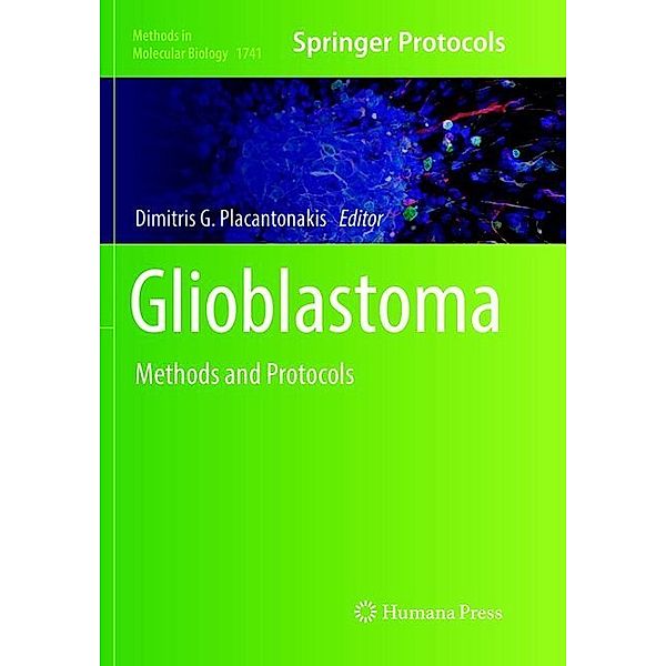 Glioblastoma