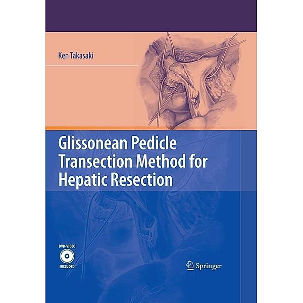 Glissonean Pedicle Transection Method for Hepatic Resection, Ken Takasaki