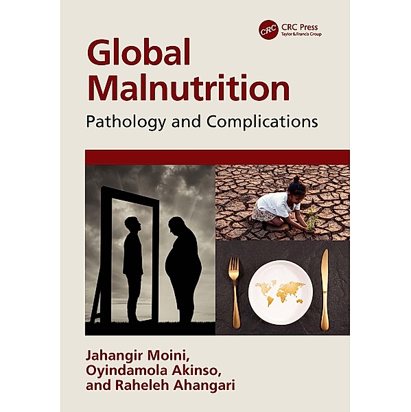 Global Malnutrition, Jahangir Moini, Oyindamola Akinso, Raheleh Ahangari