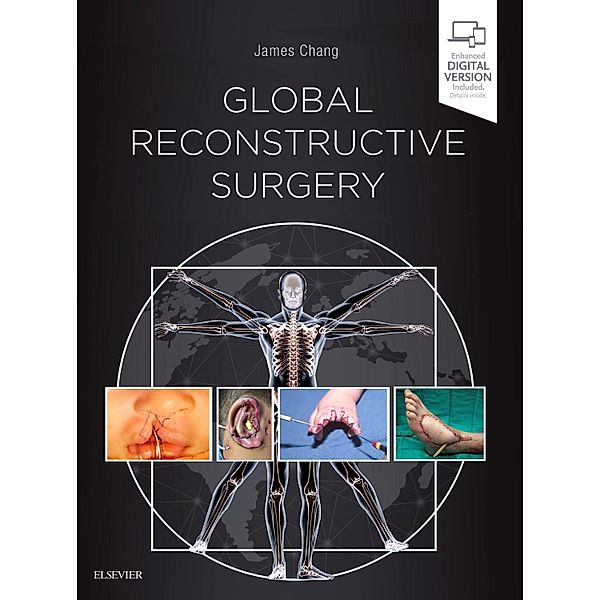 Global Reconstructive Surgery, James Chang