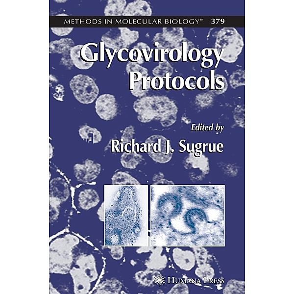 Glycovirology Protocols