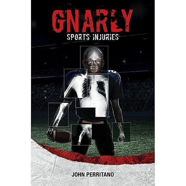 Gnarly Sports Injuries, John Perritano John
