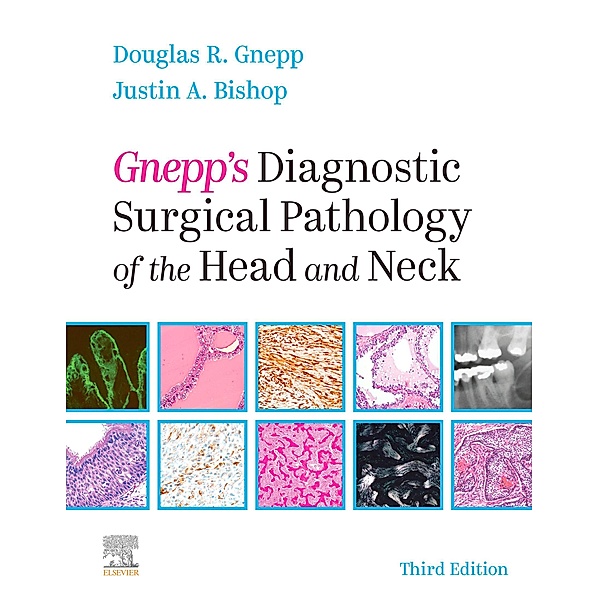 Gnepp's Diagnostic Surgical Pathology of the Head and Neck E-Book, Douglas R. Gnepp, Justin A. Bishop