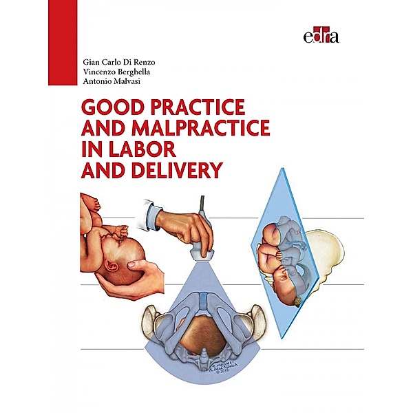 Good practice and malpractice in labor and delivery, Gian Carlo Di Renzo, Vincenzo Berghella, Antonio Malvasi