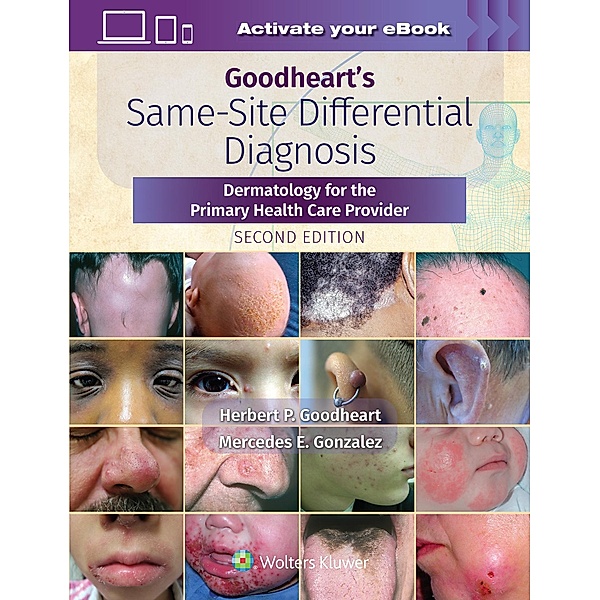 Goodheart's Same-Site Differential Diagnosis, Herbert Goodheart, Mercedes Gonzales