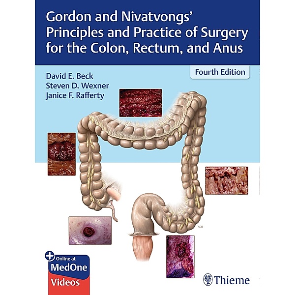 Gordon and Nivatvongs' Principles and Practice of Surgery for the Colon, Rectum, and Anus, David E. Beck, Steven D. Wexner, Janice F. Rafferty
