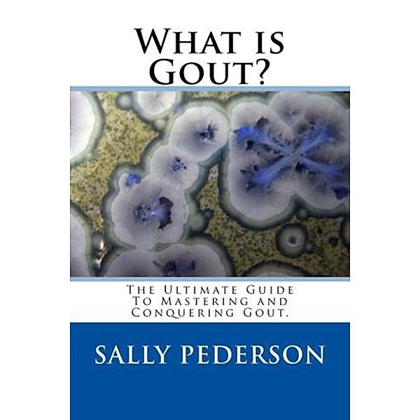 Gout: The Ultimate Guide To Mastering And Conquering Gout, Sally Pederson