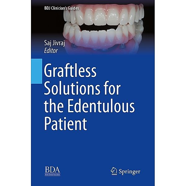 Graftless Solutions for the Edentulous Patient / BDJ Clinician's Guides