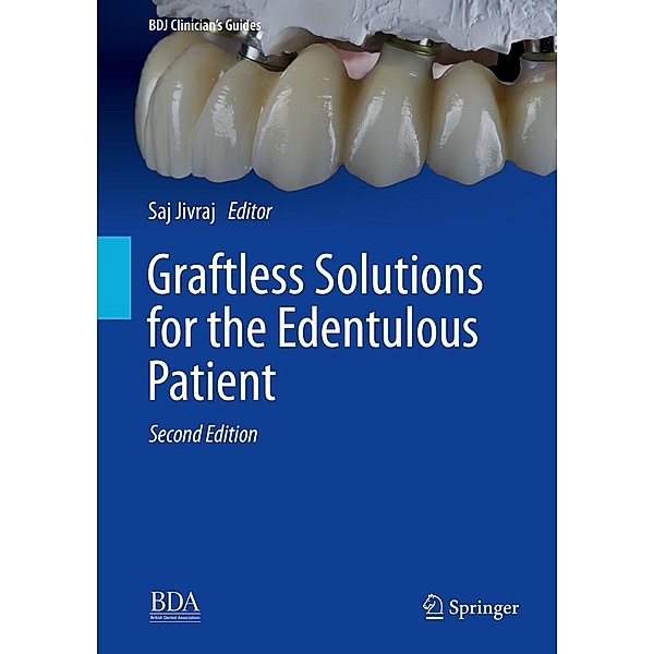 Graftless Solutions for the Edentulous Patient / BDJ Clinician's Guides