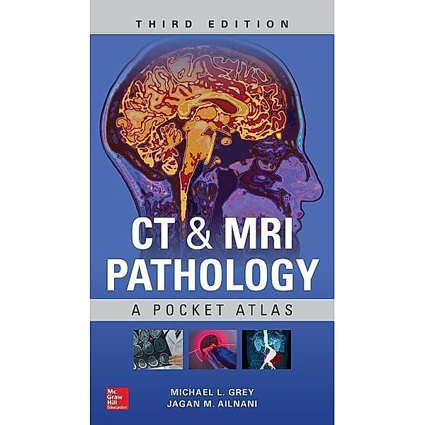 Grey, M: CT & MRI Pathology: A Pocket Atlas, Michael L. Grey, Jagan Mohan Ailinani