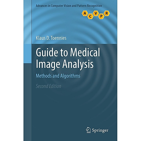 Guide to Medical Image Analysis / Advances in Computer Vision and Pattern Recognition, Klaus D. Toennies