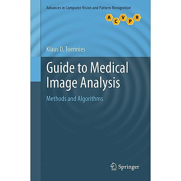 Guide to Medical Image Analysis / Advances in Computer Vision and Pattern Recognition, Klaus D. Toennies