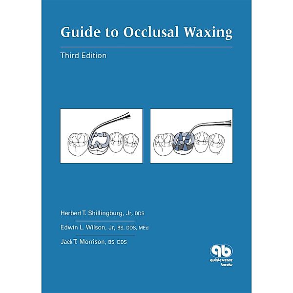 Guide to Occlusal Waxing, Herbert T. Shillingburg Jr, Edwin L. Wilson Jr, Jack T. Morrison