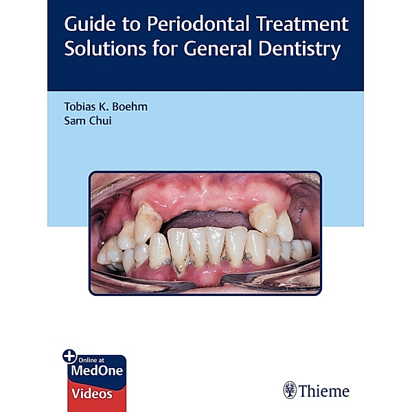 Guide to Periodontal Treatment Solutions for General Dentistry, Tobias K. Boehm, Sam Chui