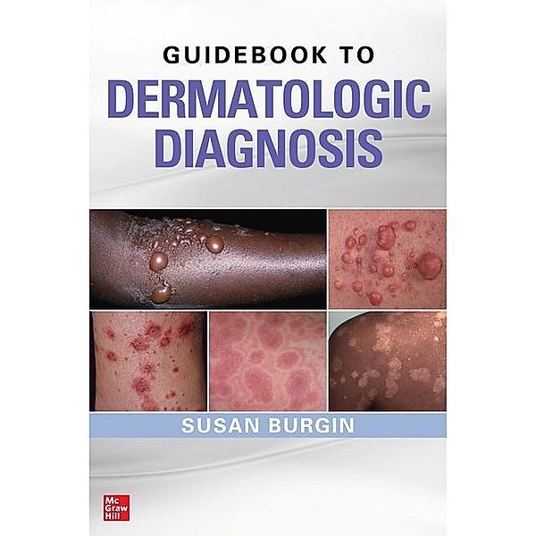 Guidebook to Dermatologic Diagnosis, Susan Burgin