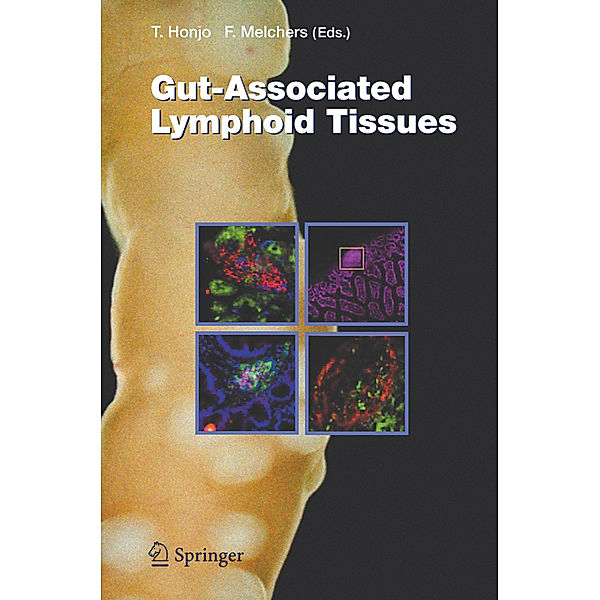 Gut-Associated Lymphoid Tissues