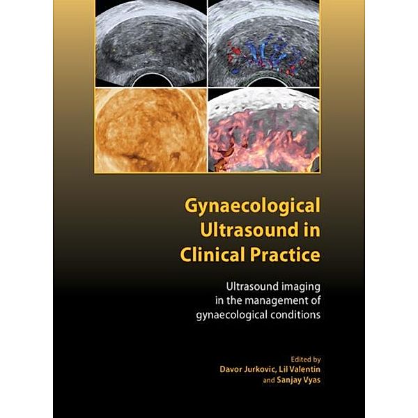 Gynaecological Ultrasound in Clinical Practice