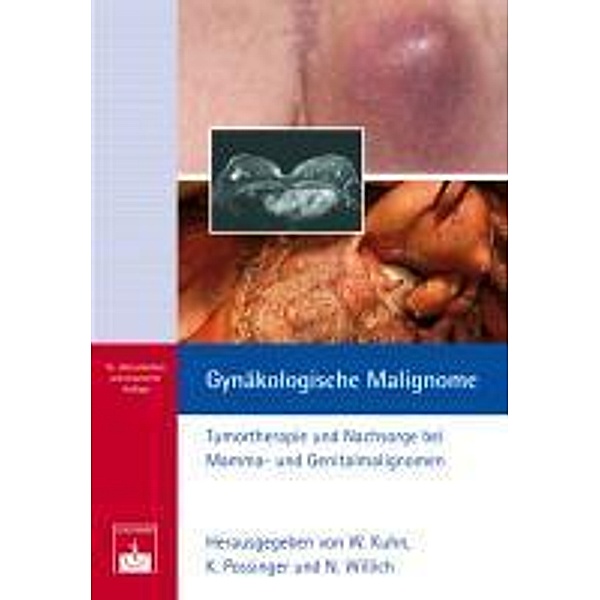 Gynäkologische Malignome, W. Kuhn, K. Possinger, N. Willich