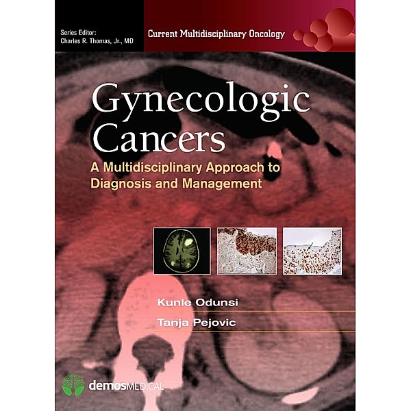 Gynecologic Cancers / Current Multidisciplinary Oncology