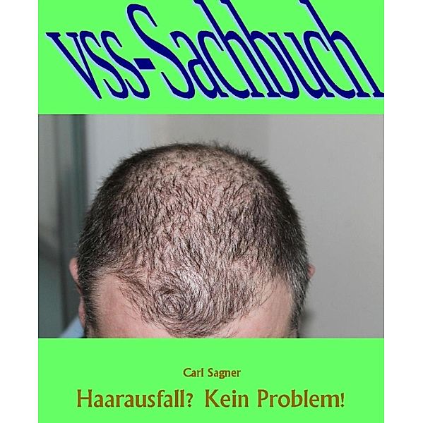 Haarausfall? Kein Problen!, Carl Sagner