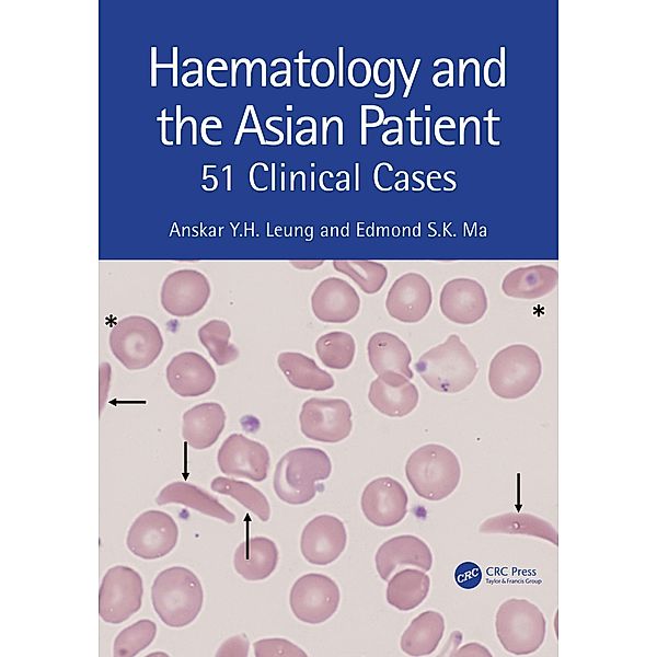 Haematology and the Asian Patient, Anskar Y. H. Leung, Edmond S K Ma